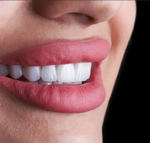 Dental Implant Before & After - Before